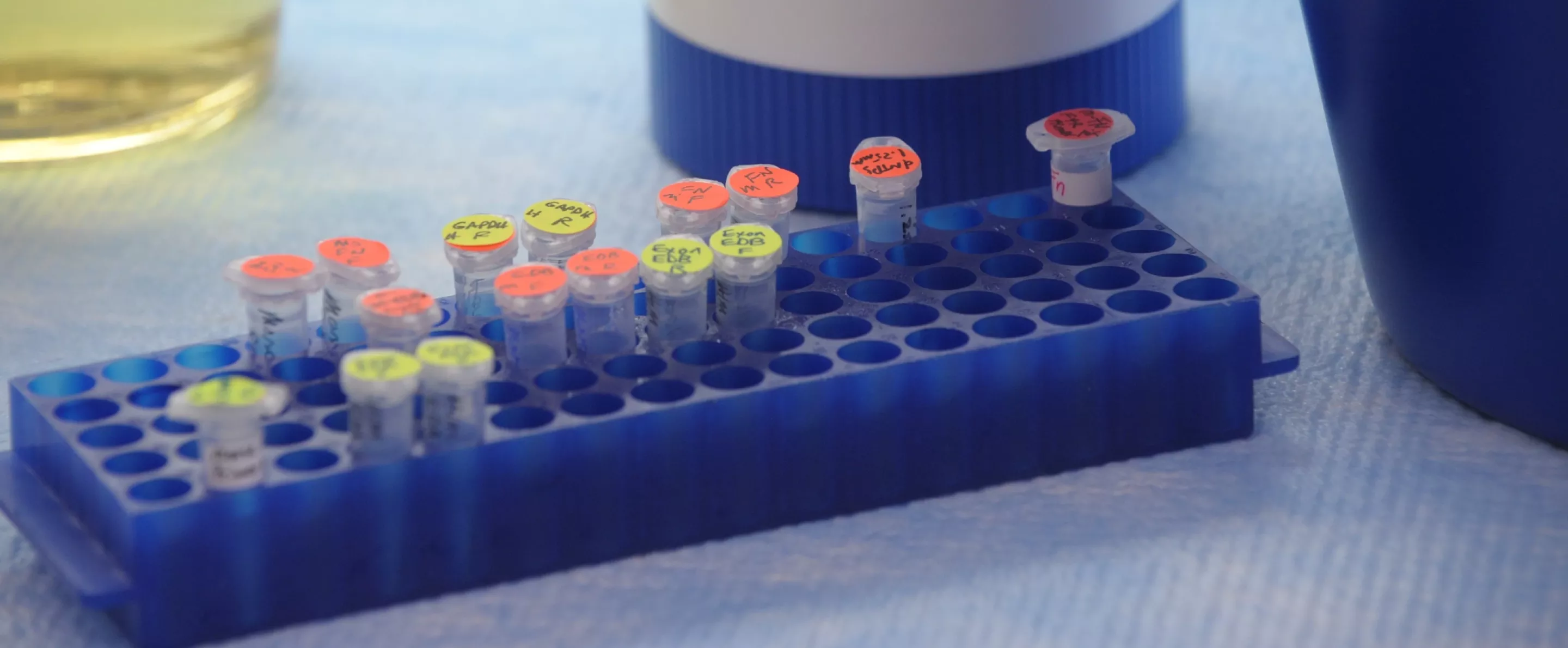 Close-up of various lab equipment, vials in a blue container